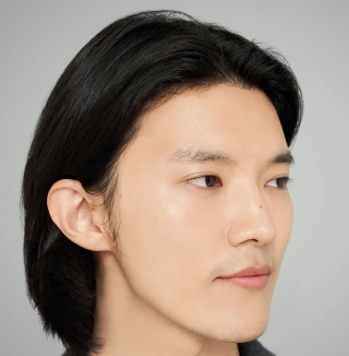 Jawline-Filler Behandlung – Contouring des unteren Gesichts